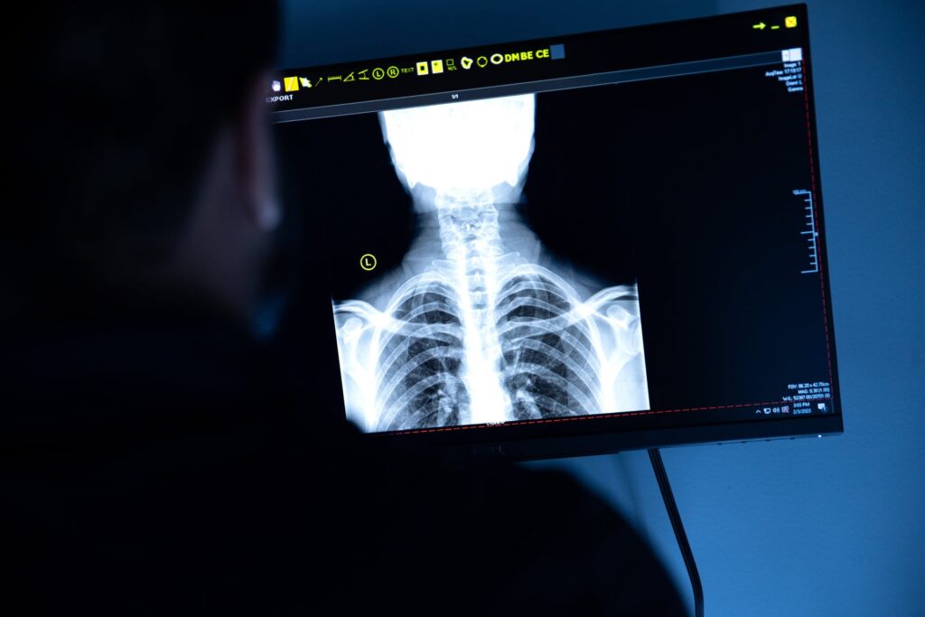 Chiropractor performing a spinal adjustment on a patient, illustrating techniques for migraine relief